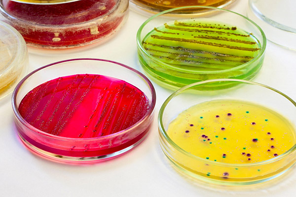 КОНКУРС НАУЧНЫХ СТУДЕНЧЕСКИХ РАБОТ ПО МИКРОБИОЛОГИИ