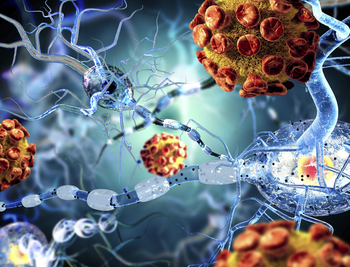 ВНУТРИВУЗОВСКАЯ ОЛИМПИАДА ПО ЭПИДЕМИОЛОГИИ