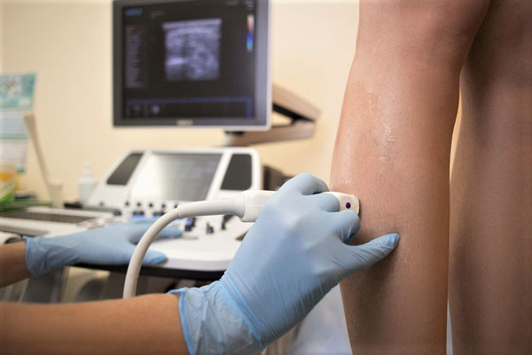 СОТРУДНИКИ РЯЗГМУ И КАРДИОДИСПАНСЕРА РАЗРАБОТАЛИ СПОСОБ РАННЕЙ ДИАГНОСТИКИ ВАРИКОЗНОЙ БОЛЕЗНИ