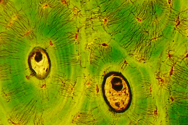 Всероссийская конференция «Современные проблемы гистологии и патологии скелетных тканей»