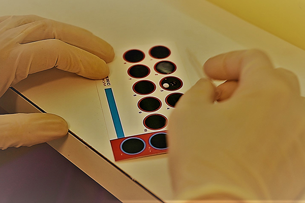 САМЫЙ РАСПРОСТРАНЕННЫЙ МЕТОД ЛАБОРАТОРНОЙ ДИАГНОСТИКИ